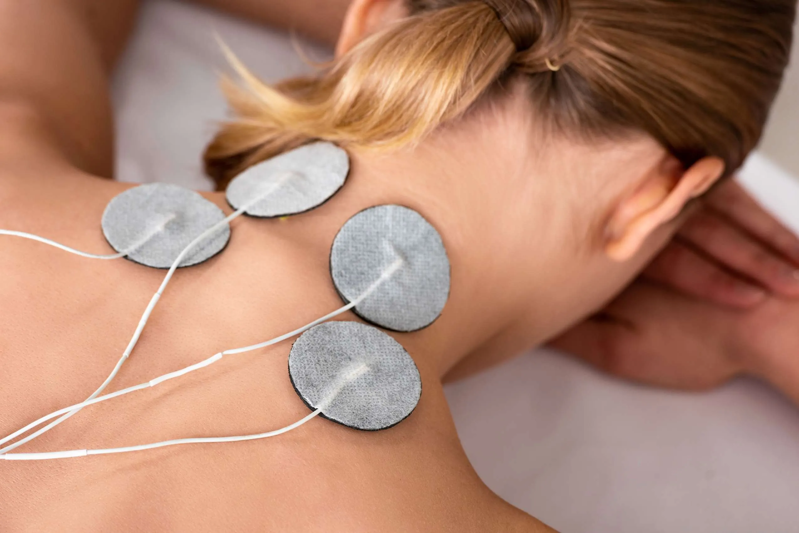 Rückenansicht einer jungen Frau mit aufgeklebten Elektroden im Rahmen einer Elektrotherapie